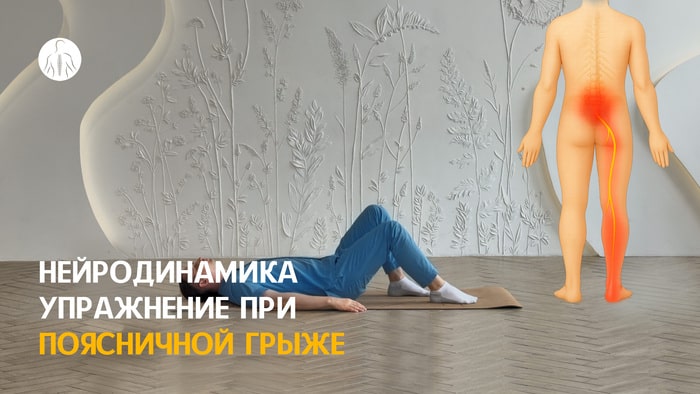 Нейродинамика: упражнение при при грыжах и протрузиях поясницы, уровень 1