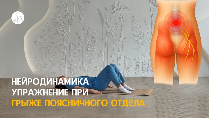 Нейродинамика: упражнение при грыже поясничного отдела позвоночника, уровень 1